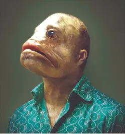 p996010