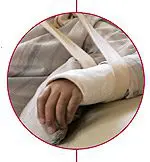 arm